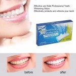 Bandes de blanchiment des dents - 14 jours sur Mbote Shop